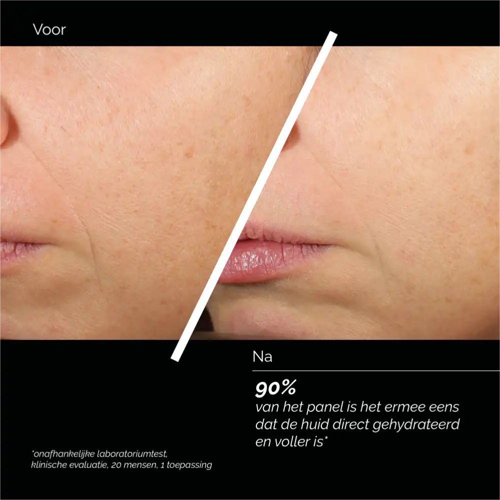 Skin Regimen LX HA4 Jelly Serum 30ml voor een huid die extra verzorging nodig heeft