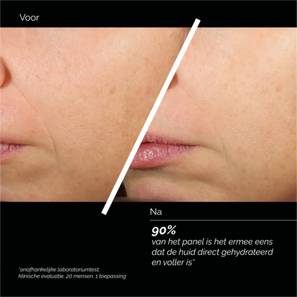 Skin Regimen LX HA4 Jelly Serum 30ml voor een huid die extra verzorging nodig heeft