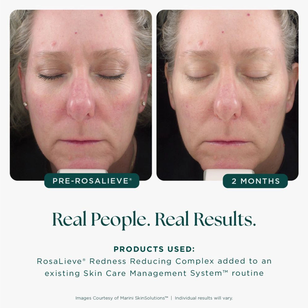 Jan Marini Rosalieve Redness Reducing Complex 30ml Jan Marini huidverzorging