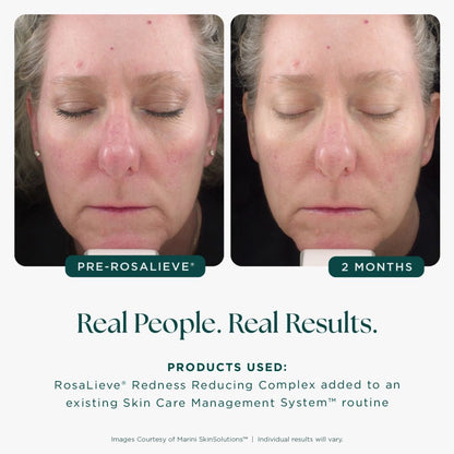 Jan Marini Rosalieve Redness Reducing Complex 30ml Jan Marini huidverzorging